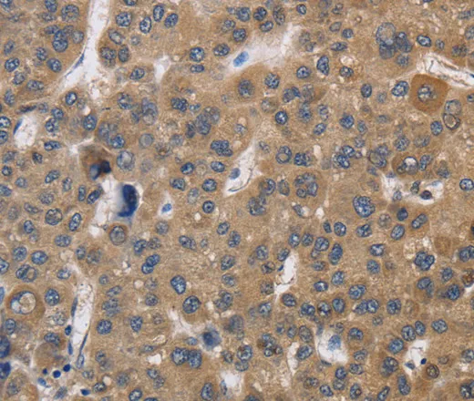 SDCCAG3 Polyclonal Antibody - image 1