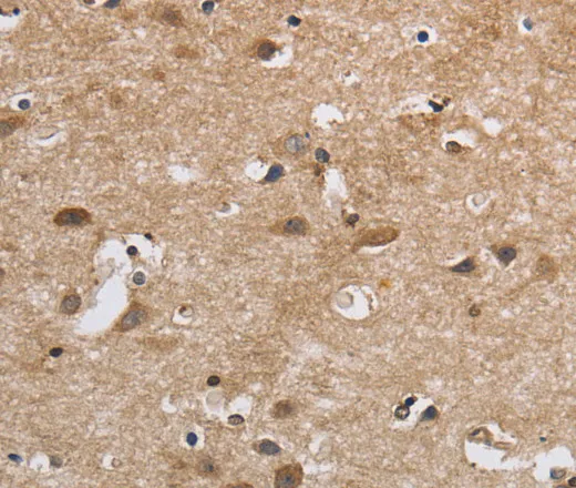 SDCCAG3 Polyclonal Antibody - image 2