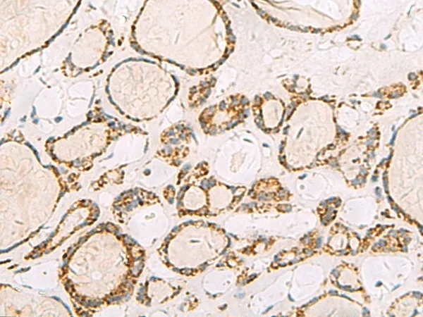 ISOC2 Polyclonal Antibody - image 1