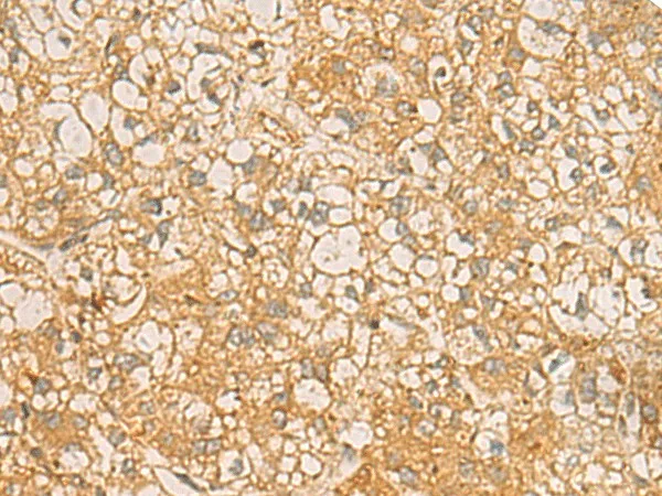 FAAP100 Polyclonal Antibody - image 1