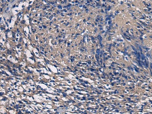 SSH3 Polyclonal Antibody - image 1