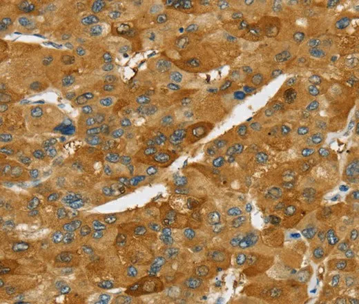 TNFSF15 Polyclonal Antibody - image 1