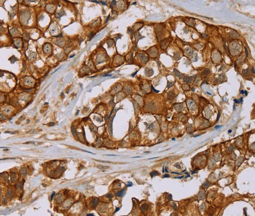 MTUS1 Polyclonal Antibody - image 1