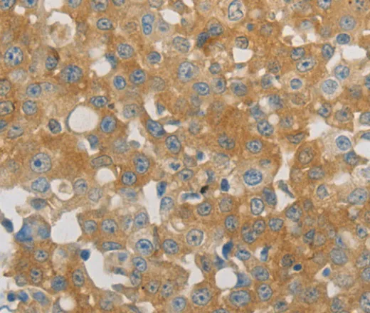 PLPP1 Polyclonal Antibody - image 1