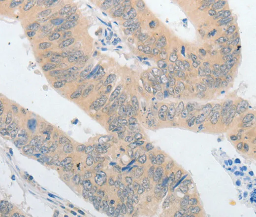 PLPP1 Polyclonal Antibody - image 2