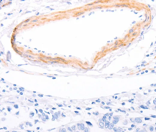 TPM1 Polyclonal Antibody - image 1