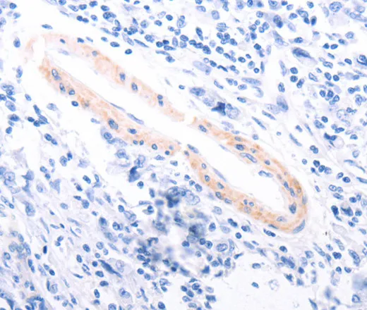 TPM1 Polyclonal Antibody - image 2