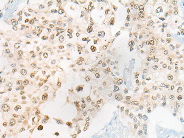 CEP72 Polyclonal Antibody - image 1