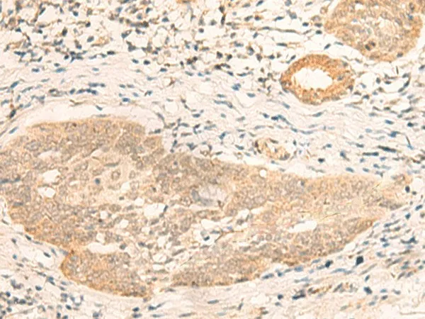 CALCOCO1 Polyclonal Antibody - image 1