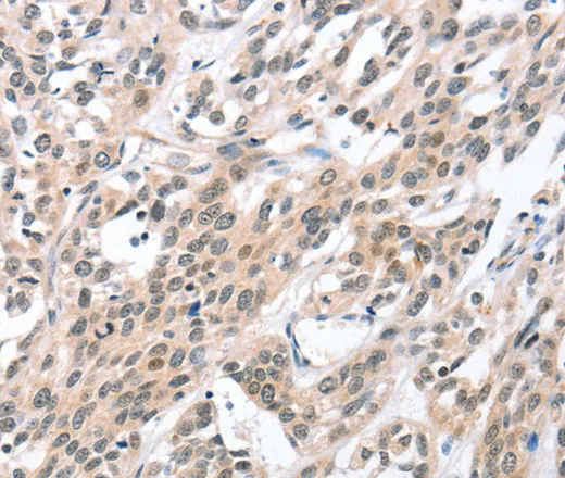 HDAC8 Polyclonal Antibody - image 1