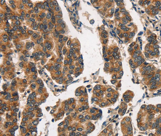 ITGA2 Polyclonal Antibody - image 1