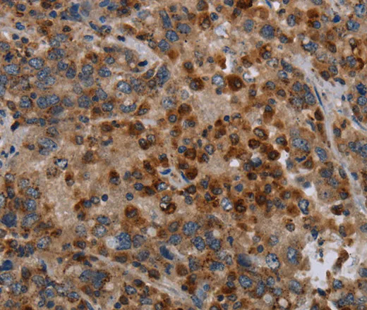 MAP3K11 Polyclonal Antibody - image 1