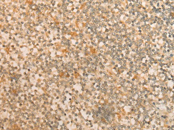 CFHR2 Polyclonal Antibody - image 1
