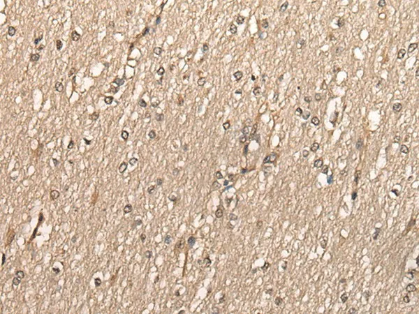 PCNA Polyclonal Antibody - image 1