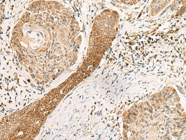 EXD2 Polyclonal Antibody - image 1