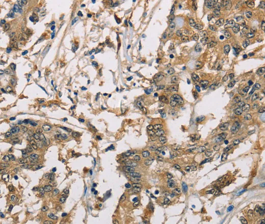 CBR1 Polyclonal Antibody - image 1