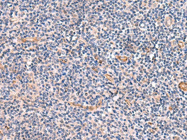 INSM2 Polyclonal Antibody - image 1