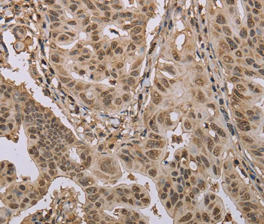 CAB39 Polyclonal Antibody - image 1