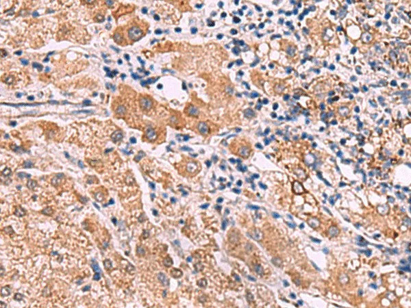 IPPK Polyclonal Antibody - image 1