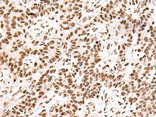 FOXK2 Polyclonal Antibody - image 1