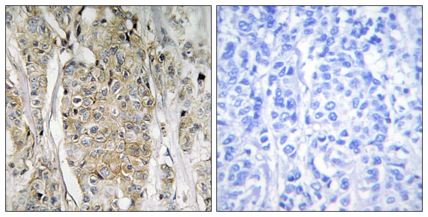ERBB2 Polyclonal Antibody - image 1