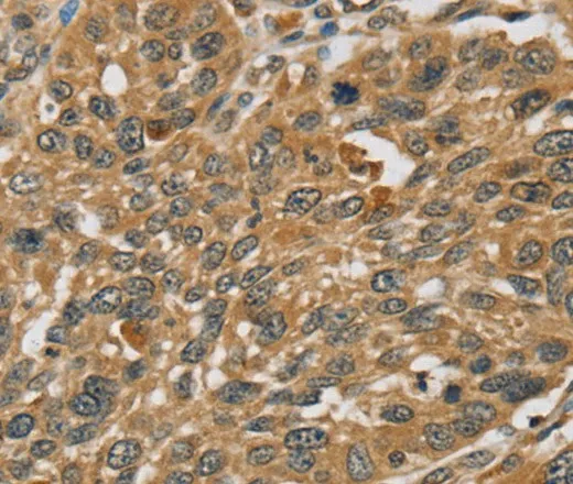 RNF5 Polyclonal Antibody - image 1