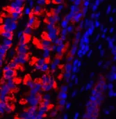 MMP2 Polyclonal Antibody - image 1
