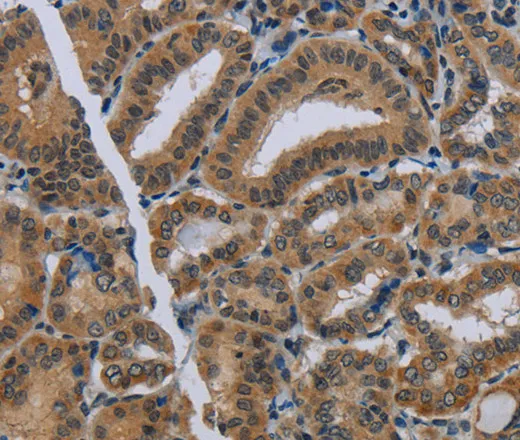 NAT10 Polyclonal Antibody - image 1