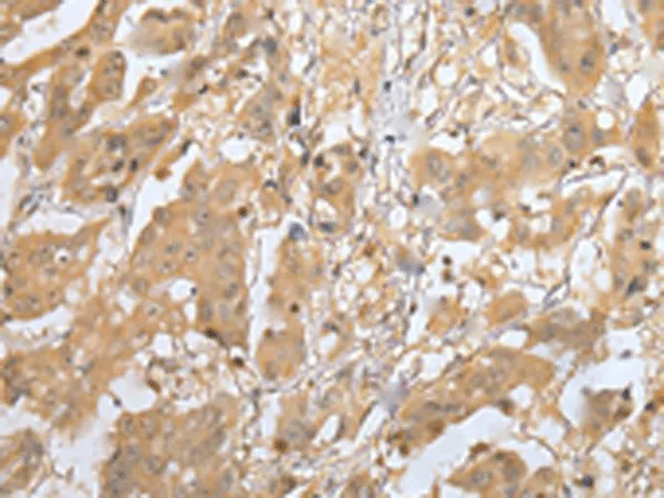 MOB4 Polyclonal Antibody - image 1