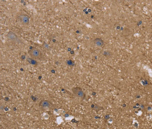 C-Rel Polyclonal Antibody - image 1