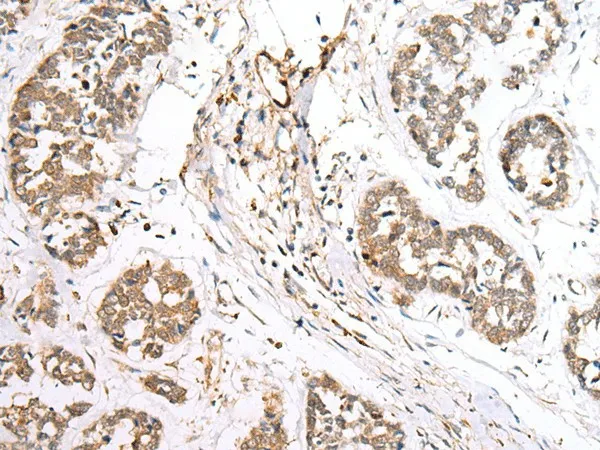 BAG2 Polyclonal Antibody - image 1