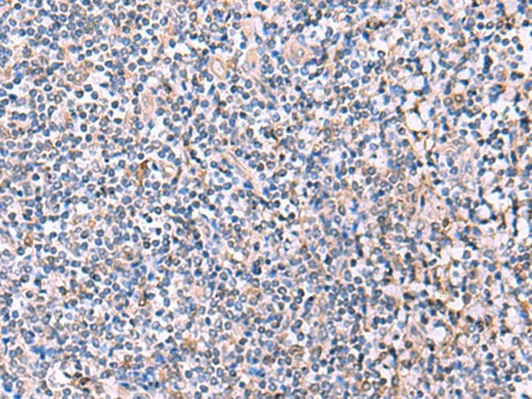 PEPD Polyclonal Antibody - image 1