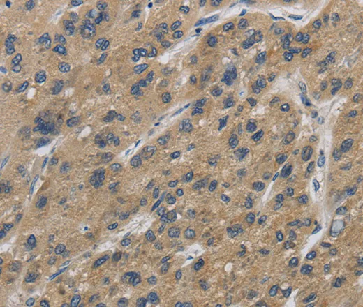 IPO7 Polyclonal Antibody - image 1