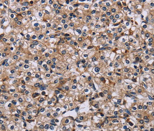 IPO4 Polyclonal Antibody - image 1