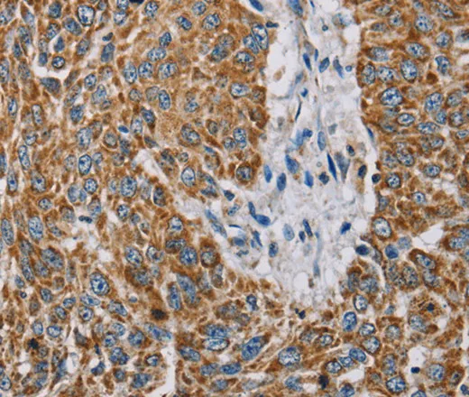 MTFP1 Polyclonal Antibody - image 1
