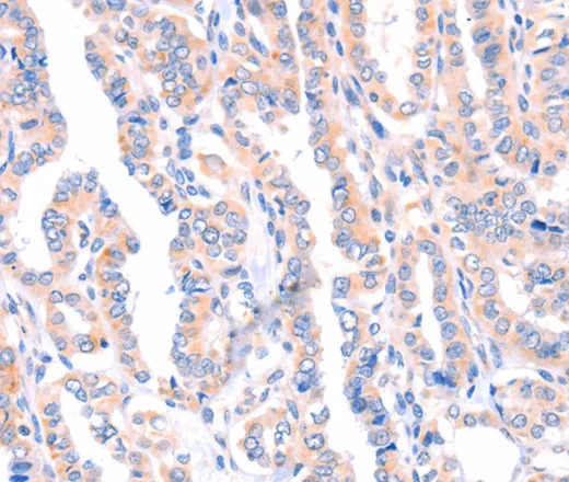 AMPD1 Polyclonal Antibody - image 1