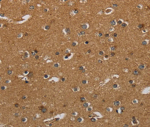 HSD17B2 Polyclonal Antibody - image 1
