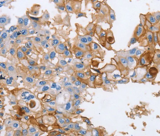 CD54 Polyclonal Antibody - image 1