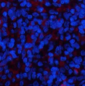 YAP1 Polyclonal Antibody - image 1