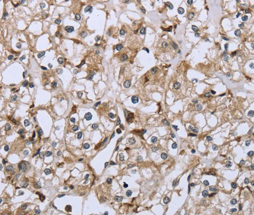 CD32 Polyclonal Antibody - image 1