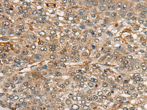 CDT1 Polyclonal Antibody - image 1