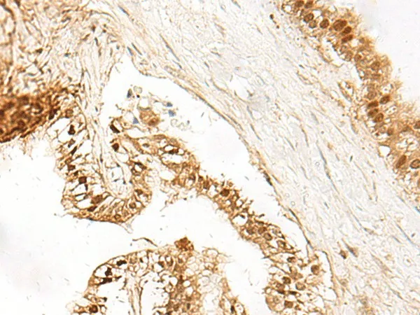 LDHA Polyclonal Antibody - image 1