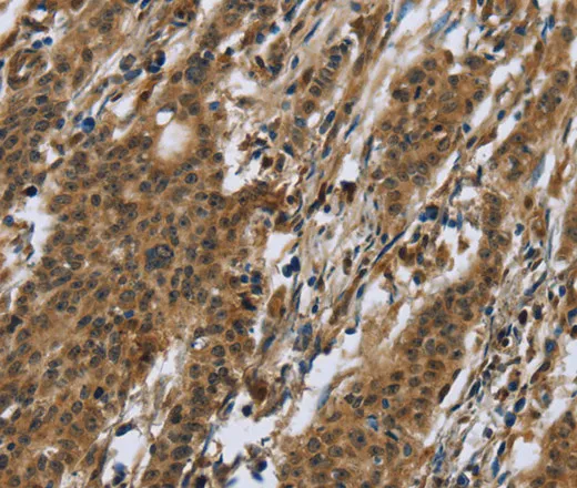RAP1B Polyclonal Antibody - image 1