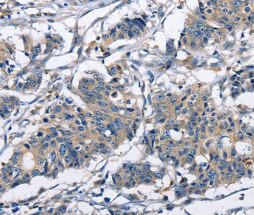 CAPZA2 Polyclonal Antibody - image 1