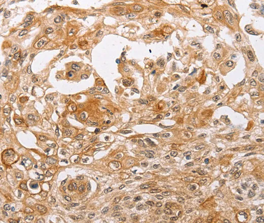 PPP1CB Polyclonal Antibody - image 1