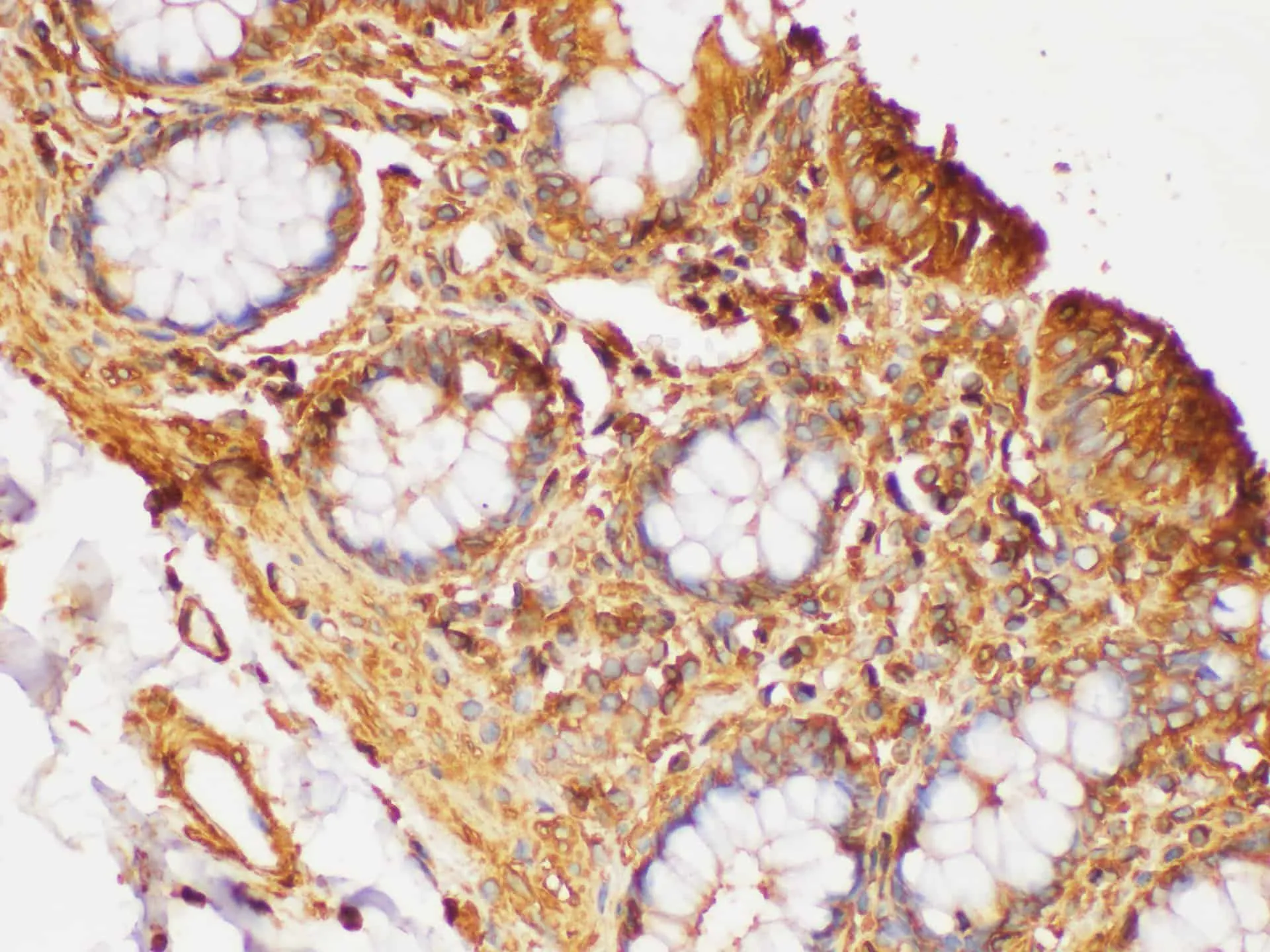 Beta actin Polyclonal Antibody - image 2