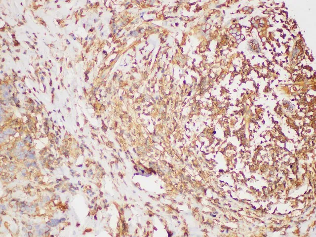 Beta actin Polyclonal Antibody - image 3