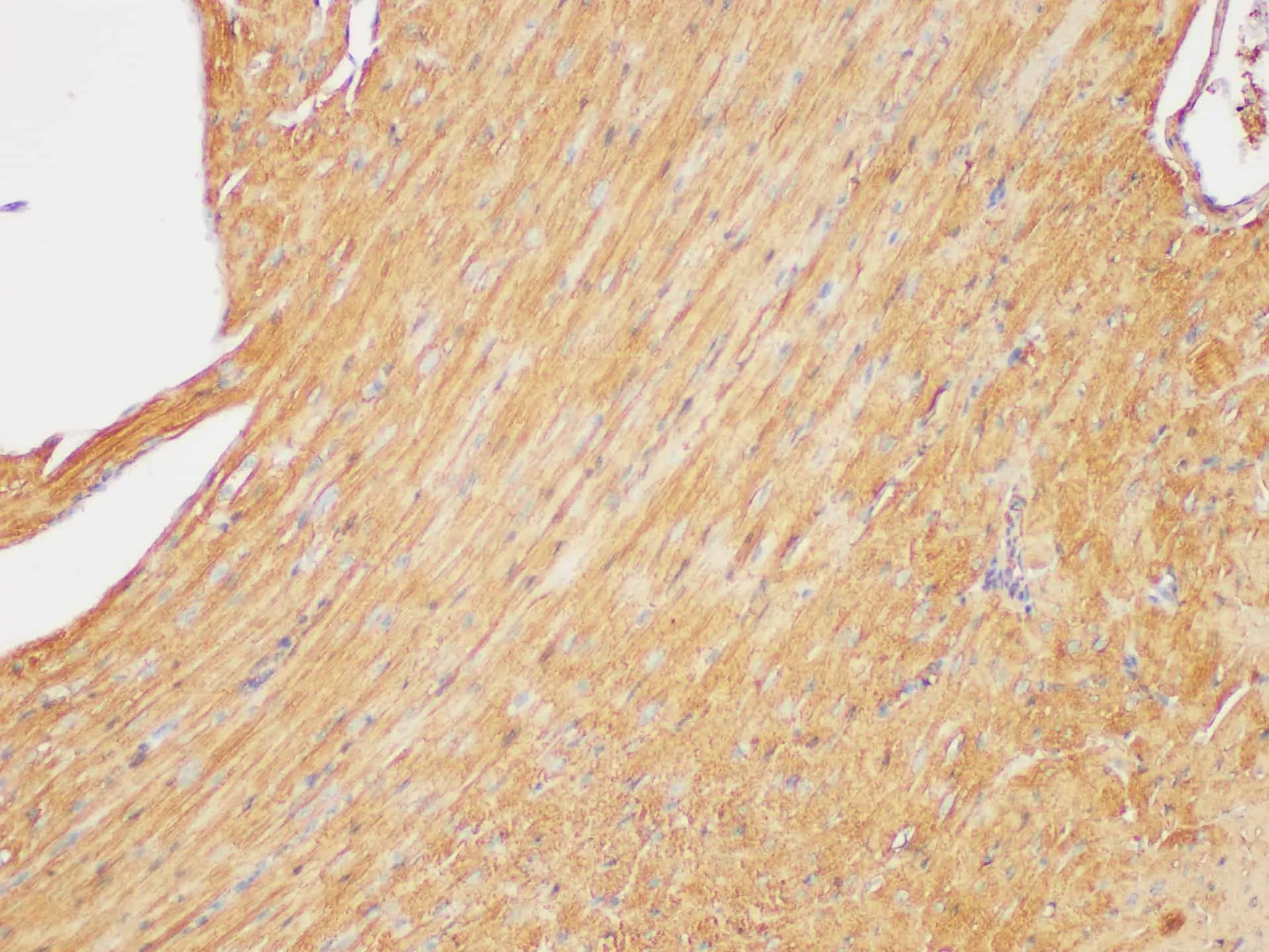 Beta actin Polyclonal Antibody - image 4