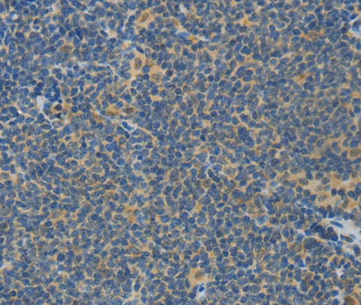 ASPA Polyclonal Antibody - image 1