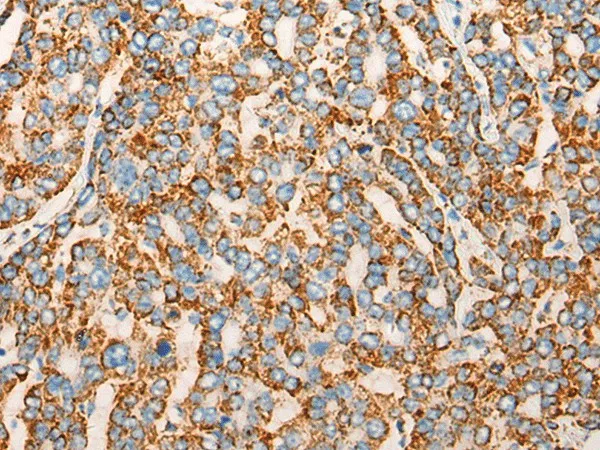 CHCHD3 Polyclonal Antibody - image 1
